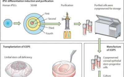 Human vision restored by stem cell replacement in regenerative medicine breakthrough