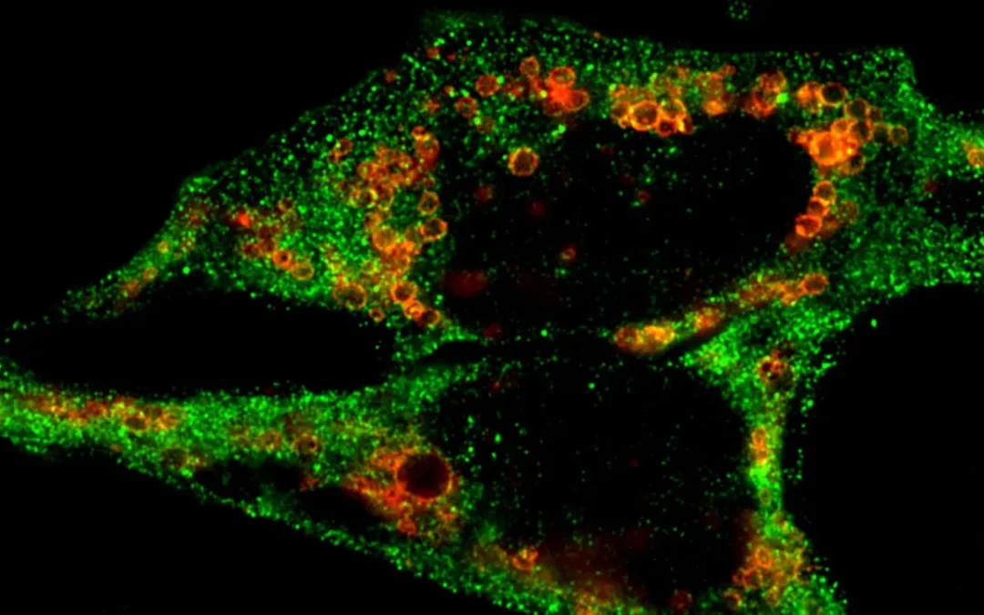 Cancer Cells Spread When They Stop Recycling Waste