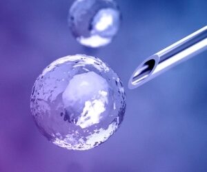 Stem cell treatment – excitement is understandable but let’s tread carefully