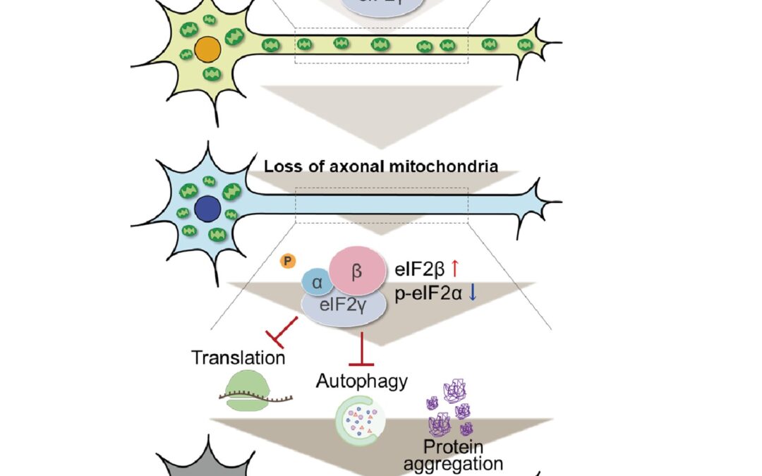 Study shows how depletion of mitochondria in axons can directly lead to protein accumulation