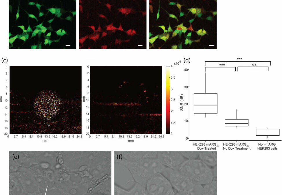Novel approach to engineered cells may enable molecular medical imaging