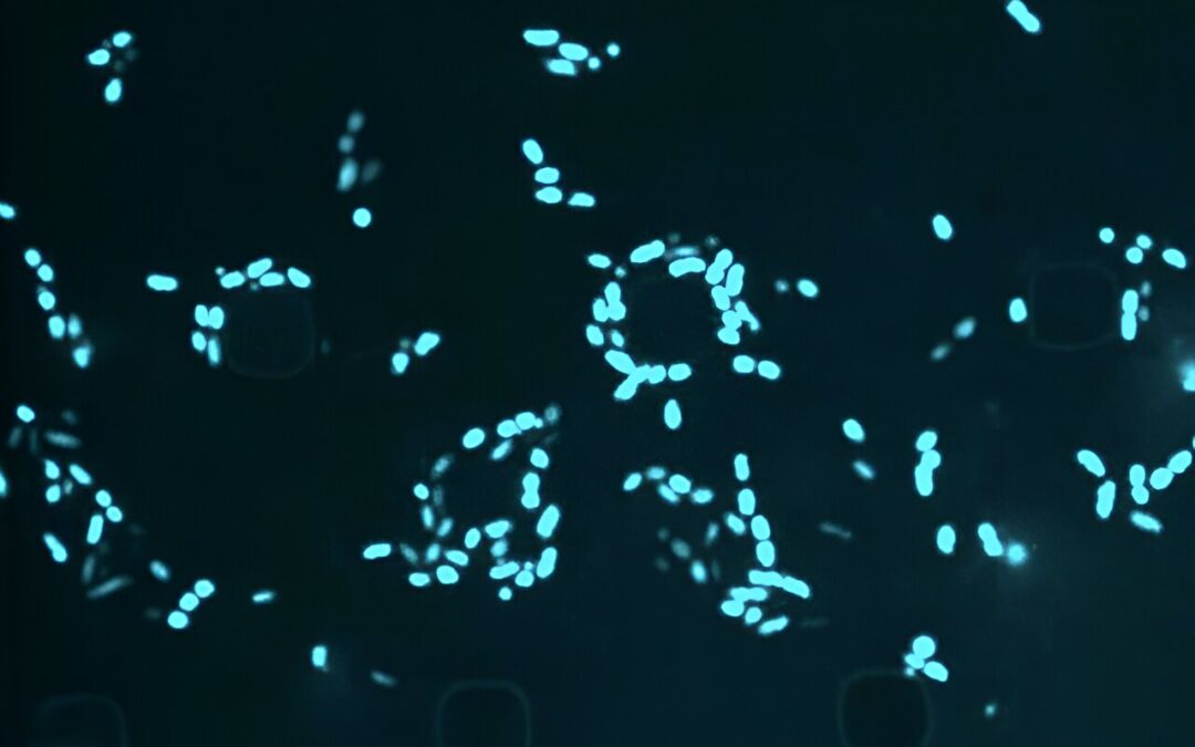 When an antibiotic fails: Scientists are using AI to target ‘sleeper’ bacteria