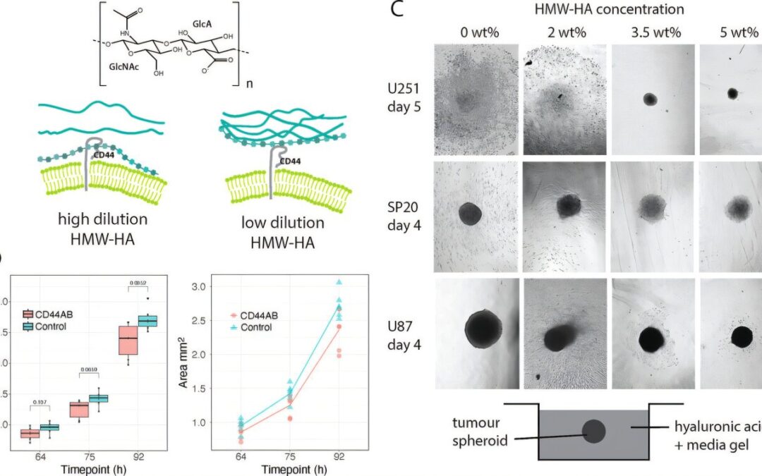 Brain cancer cells can be ‘reprogrammed’ to stop them from spreading.