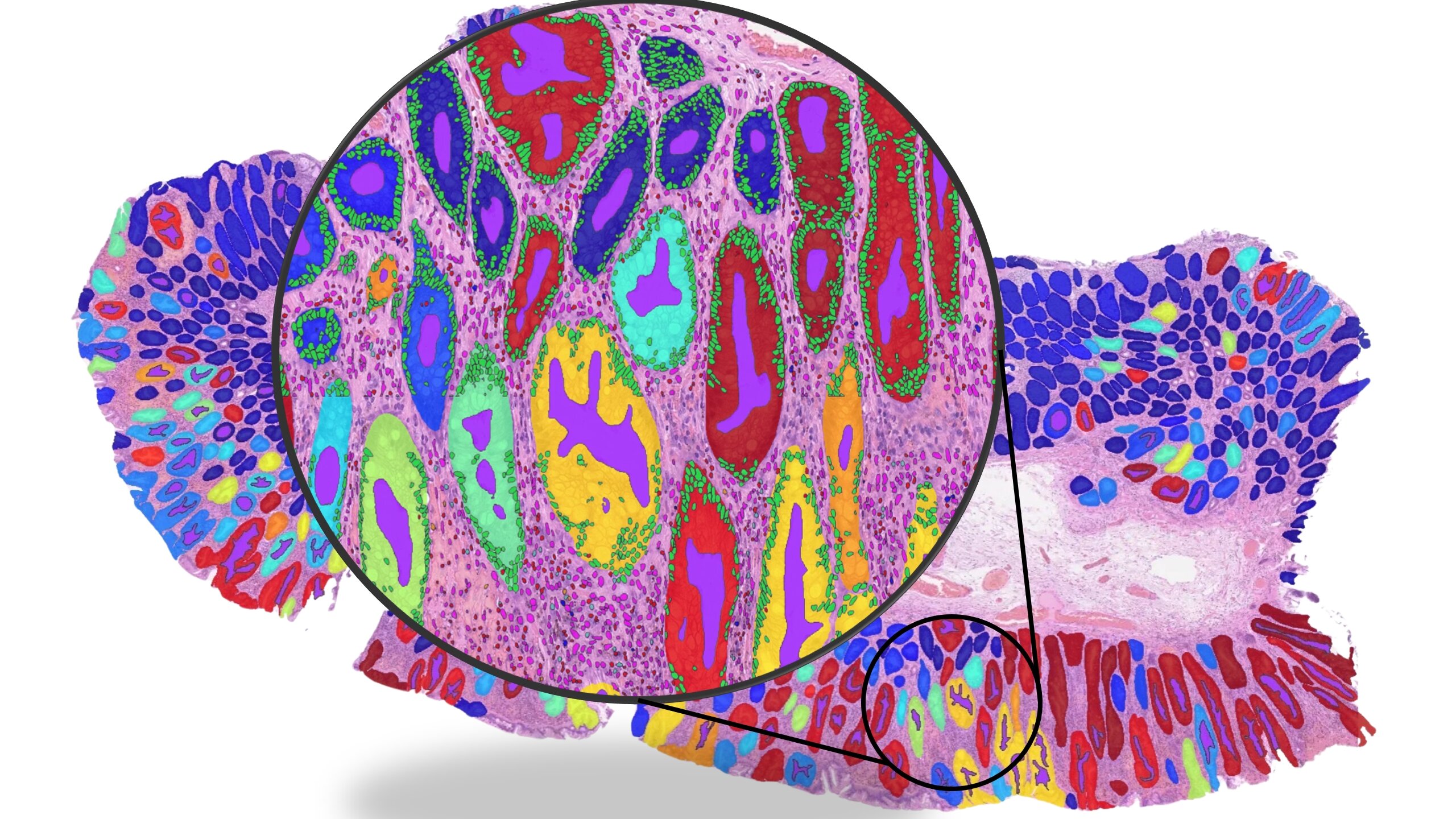 ai-cancer-tools-risk-s