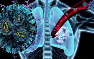 A nanoparticle therapy to treat lung cancer and associated muscle wasting at the same time
